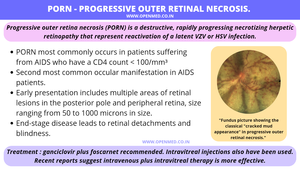 Disease Porn - PORN - Progressive Outer Retinal Necrosis.