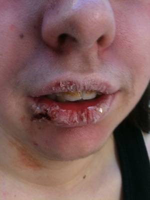 Meth Mouth Porn - 2013-02-15-12-20-15.jpg 1,536Ã—2,048