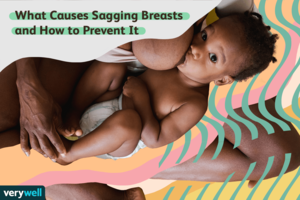 flat lactating breast nude - Causes and Prevention of Sagging Breasts