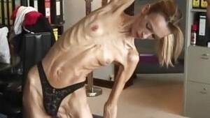 anorexic milk skinned - Anorexic Milk Skin | Sex Pictures Pass