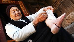 bound asian feet - Zhou Guizhen who is 86 years old, shows one of her bound feet where the