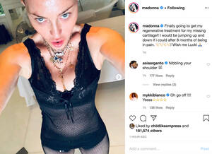 Madonna Ass Porn - Madonna, 61, bares butt in see-through panties as she prepares for  'regenerative treatment' for her 'missing cartilage' | The US Sun