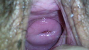 Beautiful Cervix Porn - A Beautiful Cervix | xHamster