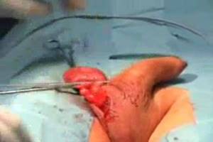 Gore Castration Porn - 