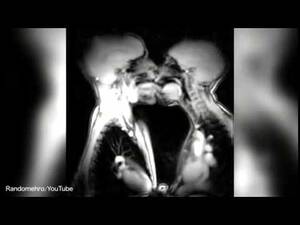 Mri Porn - MRI porn: scans take a look at internal organs during sex - Coub - The  Biggest Video Meme Platform