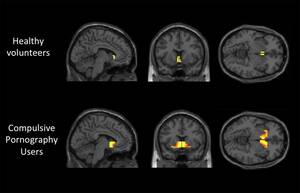 Internet Porn Addiction - Pornography addiction leads to same brain activity as alcoholism or drug  abuse, study shows | The Independent | The Independent