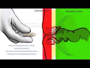 Liquid Suppository - Xxx Mp4 Medical Media Design Explainer Video Animation How To Insert  Suppository To Unconscious Children 3gp Â»