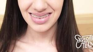 Braces Porn Tube - Braces Porn Movies - Free Sex Videos | TubeGalore