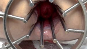 extreme anal speculum - gs2, BDSM Mistress, massive anal speculum, wide open ass, strapon, extreme  anal gap - XVIDEOS.COM