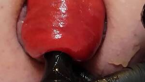 Biggest Prolapse Porn Ever - Contender For Biggest Prolapse (Male Warning!) - XVIDEOS.COM