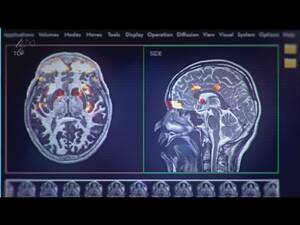 Mri Porn - i.ytimg.com/vi/OtQBxsf1st8/sddefault.jpg