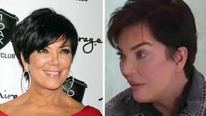 Kim Kardashian Cumshot Porn - Kris Jenner's Facial Transformation Sparks Frenzy