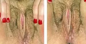 hot transgender pussy - What do the genitals of transgender people look like (vaginas, penises,  something else)? - Quora