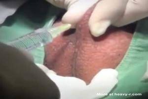castrated transexual porn - Scary Castration Video