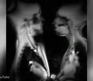 Mri Porn - MRI porn: scans take a look at internal organs during sex - Coub - The  Biggest Video Meme Platform