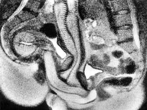 Mri Porn - Images Of Couple Who Fucked In MRI Scanner Show How Penis â€œBends Like  Boomerangâ€ | STR8UPGAYPORN