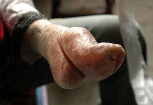 foot binding - CHINESE FOOT BINDING | BDSM Digest