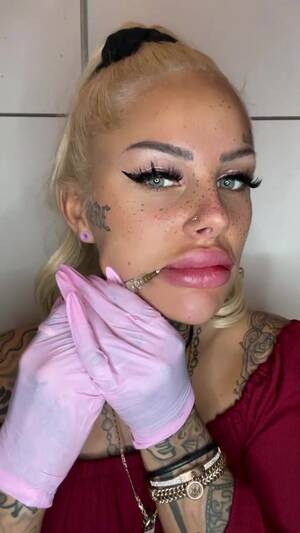 Fake Lips Porn - Fake lips filler