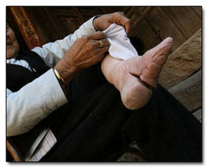 foot binding - In ...