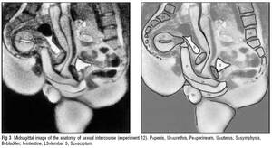 Mri Porn - OMG - super cool MRI porn - Violet Blue Â® | Open Source Sex