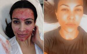 Kim Kardashian Cumshot Porn - While Kim Kardashian Fights A Legal Battle With Vampire Facial Her Sister  Kourtney Kardashian Enjoys A Blood Facial