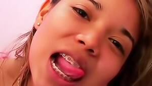 Braces Porn Tube - Braces - Free Porn Tube - Xvidzz.com