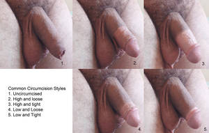 circumcised hand job - 