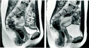 Mri Porn - We did not foresee that the men would have more problems with sexual  performance (maintaining their erection) than the women in the scanner.