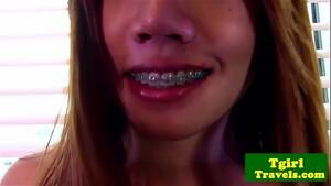 ladyboy in braces - thai ladyboy with braces strokes and poses whats her name? - XVIDEOS.COM