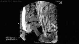 Mri Porn - MRI Archives | Porn Giphy