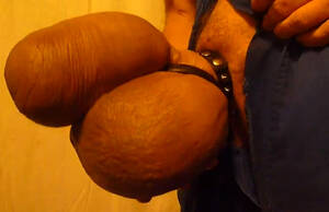 huge swollen cock - Uncut cock and balls are swollen to huge size - penis pumping porn at  ThisVid tube